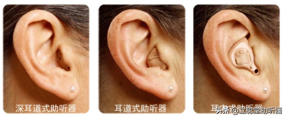 老年人助听器买哪个品牌效果比较好 老人助听器怎么选